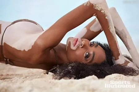 Winnie Harlow OnlyFans Leaked Free Thumbnail Picture - #k19CFtx30k