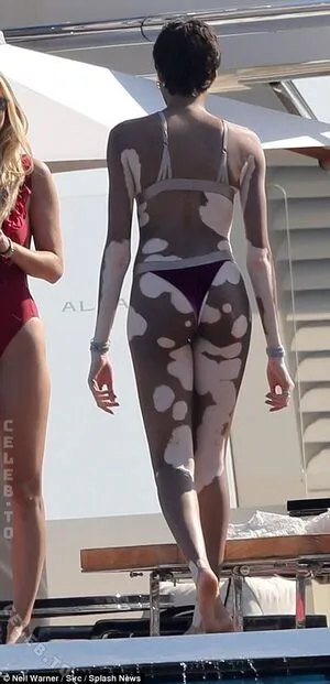 Winnie Harlow OnlyFans Leaked Free Thumbnail Picture - #kzOHgyGtPY