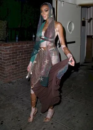 Winnie Harlow OnlyFans Leaked Free Thumbnail Picture - #lcUWqYKkNp