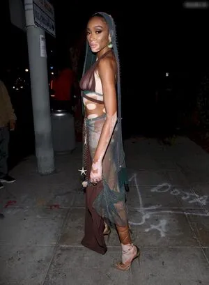 Winnie Harlow OnlyFans Leaked Free Thumbnail Picture - #ltZFHIzJci