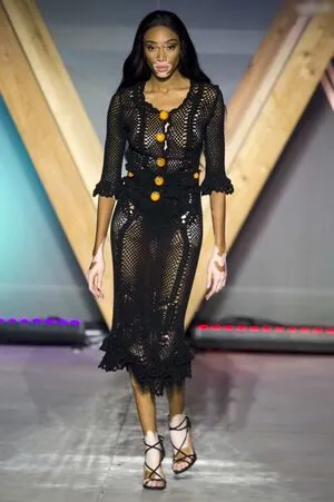 Winnie Harlow OnlyFans Leaked Free Thumbnail Picture - #lxMMMM1t3H