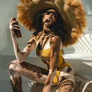 Winnie Harlow OnlyFans Leaked Free Thumbnail Picture - #m9ueVDkiqt