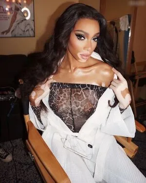 Winnie Harlow OnlyFans Leaked Free Thumbnail Picture - #mJbOxFzBz7