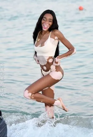 Winnie Harlow OnlyFans Leaked Free Thumbnail Picture - #mi2pxZctHO