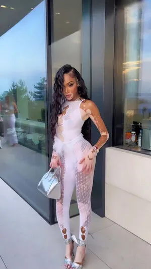 Winnie Harlow OnlyFans Leaked Free Thumbnail Picture - #midBHFWkBy