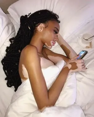 Winnie Harlow OnlyFans Leaked Free Thumbnail Picture - #mo6r7lJsvu