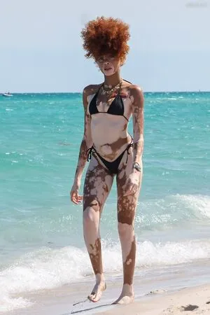 Winnie Harlow OnlyFans Leaked Free Thumbnail Picture - #mvhzL2AGh2