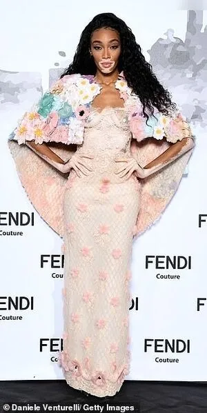 Winnie Harlow OnlyFans Leaked Free Thumbnail Picture - #ngpIwjBnhv