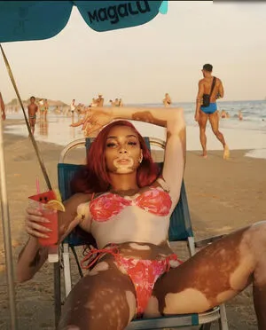 Winnie Harlow OnlyFans Leaked Free Thumbnail Picture - #o01mNilVCe