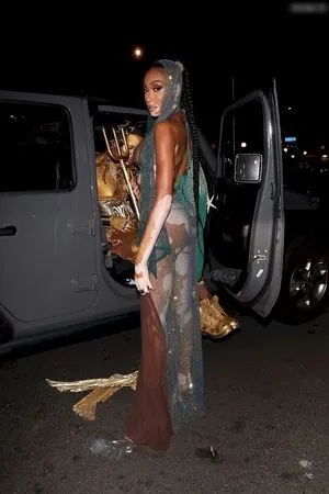Winnie Harlow OnlyFans Leaked Free Thumbnail Picture - #o25PY5GJpT
