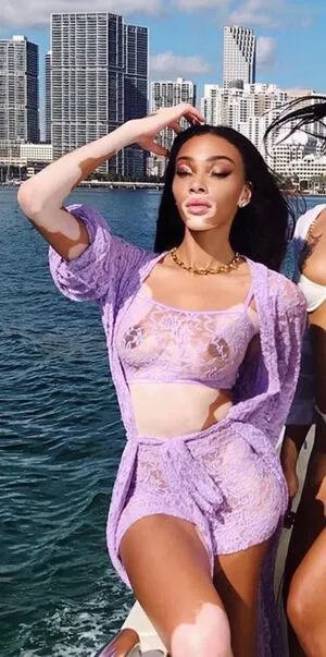 Winnie Harlow OnlyFans Leaked Free Thumbnail Picture - #oga0vkuRGo