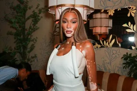 Winnie Harlow OnlyFans Leaked Free Thumbnail Picture - #ouDItWZWbs