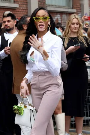 Winnie Harlow OnlyFans Leaked Free Thumbnail Picture - #ouqZePGC1H