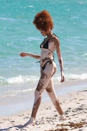 Winnie Harlow OnlyFans Leaked Free Thumbnail Picture - #pRK8nmozS8