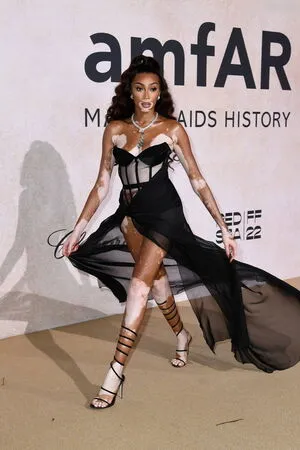 Winnie Harlow OnlyFans Leaked Free Thumbnail Picture - #qBJkzOdQSV