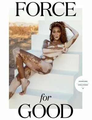 Winnie Harlow OnlyFans Leaked Free Thumbnail Picture - #qDma9sgVf1