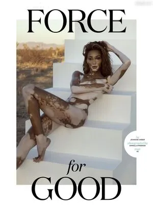 Winnie Harlow OnlyFans Leaked Free Thumbnail Picture - #qRcxOBxalP
