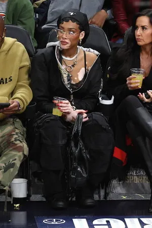 Winnie Harlow OnlyFans Leaked Free Thumbnail Picture - #qx8X7NHDZu