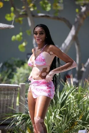 Winnie Harlow OnlyFans Leaked Free Thumbnail Picture - #r9YgucLgIv