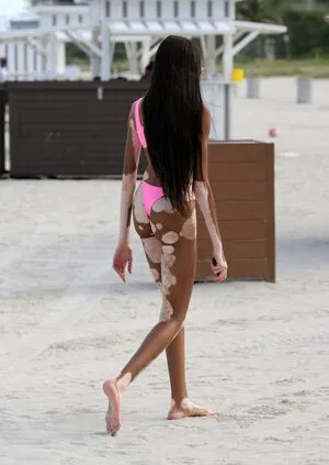Winnie Harlow OnlyFans Leaked Free Thumbnail Picture - #rjk5NALuQ5