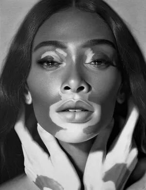 Winnie Harlow OnlyFans Leaked Free Thumbnail Picture - #s9BKVaewEN