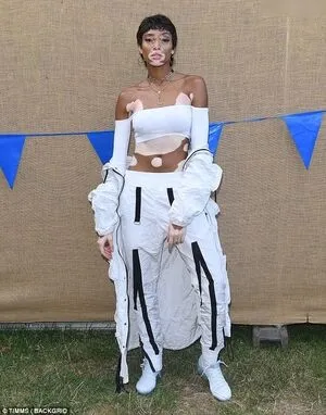 Winnie Harlow OnlyFans Leaked Free Thumbnail Picture - #tNCAwNFn8u