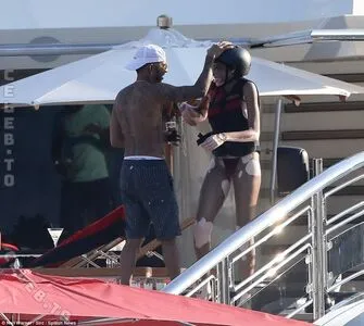 Winnie Harlow OnlyFans Leaked Free Thumbnail Picture - #thnTXx5LVR