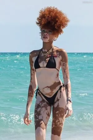 Winnie Harlow OnlyFans Leaked Free Thumbnail Picture - #u8jEjazrUc