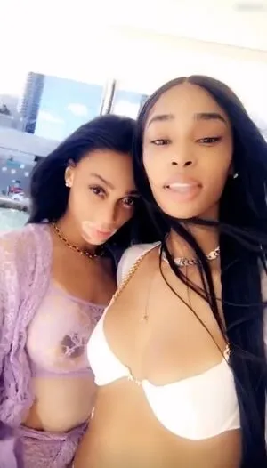 Winnie Harlow OnlyFans Leaked Free Thumbnail Picture - #uFBTfnRfZb