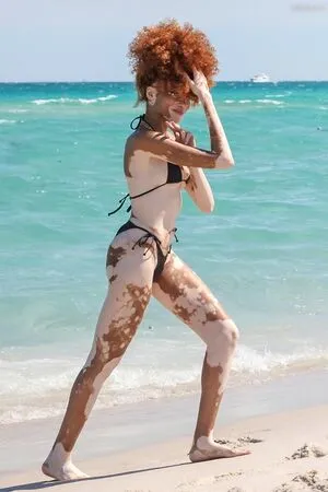 Winnie Harlow OnlyFans Leaked Free Thumbnail Picture - #vEBFrEWThh