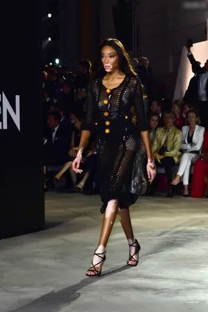 Winnie Harlow OnlyFans Leaked Free Thumbnail Picture - #vNc0FrLJVM