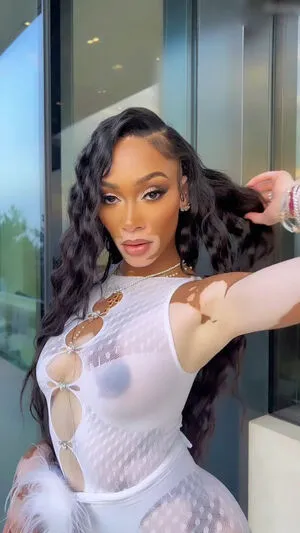 Winnie Harlow OnlyFans Leaked Free Thumbnail Picture - #vXplB8D9bX