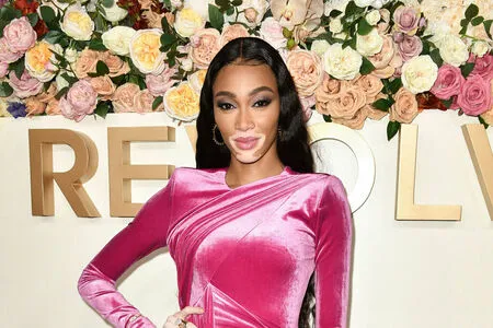 Winnie Harlow OnlyFans Leaked Free Thumbnail Picture - #wYEiQ4NPxk