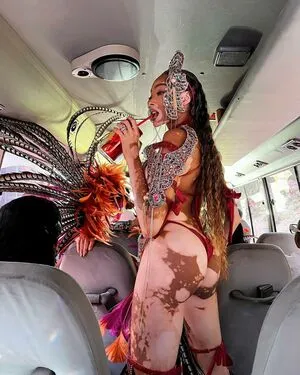 Winnie Harlow OnlyFans Leaked Free Thumbnail Picture - #wbxFKSFbPY