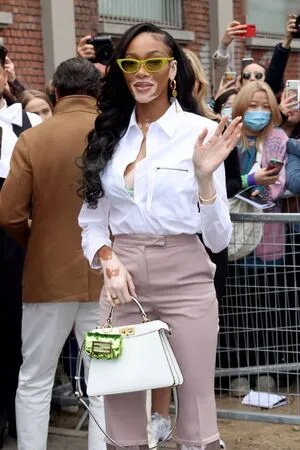 Winnie Harlow OnlyFans Leaked Free Thumbnail Picture - #wtaYzx7iwQ