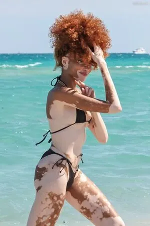 Winnie Harlow OnlyFans Leaked Free Thumbnail Picture - #x7AeSEIoSI