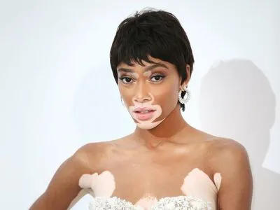 Winnie Harlow OnlyFans Leaked Free Thumbnail Picture - #xrbDnU72FL