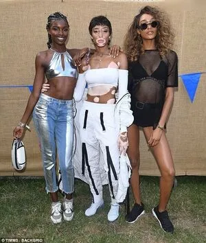 Winnie Harlow OnlyFans Leaked Free Thumbnail Picture - #xtDEgKiThy
