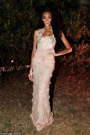 Winnie Harlow OnlyFans Leaked Free Thumbnail Picture - #xuBelfkQpP