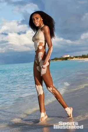 Winnie Harlow OnlyFans Leaked Free Thumbnail Picture - #xuUTo61a6l