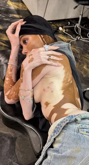 Winnie Harlow OnlyFans Leaked Free Thumbnail Picture - #yKsIbPPf3n
