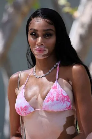Winnie Harlow OnlyFans Leaked Free Thumbnail Picture - #yZsWWJVUxC