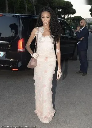 Winnie Harlow OnlyFans Leaked Free Thumbnail Picture - #zWnpizjh3T