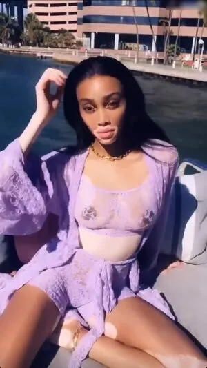 Winnie Harlow OnlyFans Leaked Free Thumbnail Picture - #zksucNFjFP