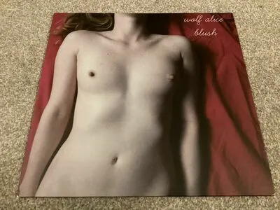Wolf Alice OnlyFans Leaked Free Thumbnail Picture - #9xcq0hwYLW
