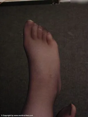 Worldoffeet OnlyFans Leaked Free Thumbnail Picture - #3cg0tL0G4g