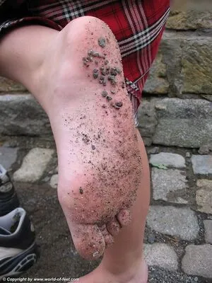 Worldoffeet OnlyFans Leaked Free Thumbnail Picture - #DEj3dZWScu