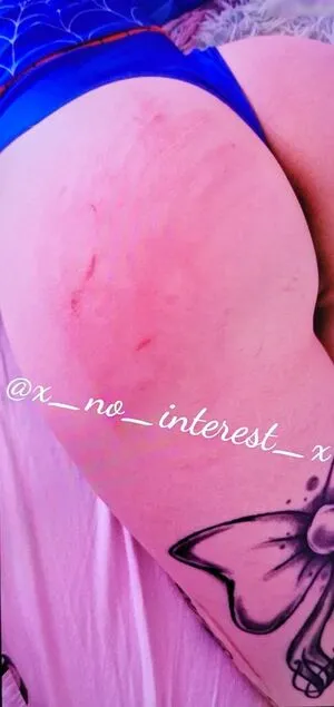 X No Interest X OnlyFans Leaked Free Thumbnail Picture - #2BHbuJWhq4