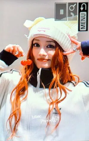 Xgofficial OnlyFans Leaked Free Thumbnail Picture - #URjhzy4aMN