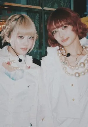 Xgofficial OnlyFans Leaked Free Thumbnail Picture - #pZcXGva0dM